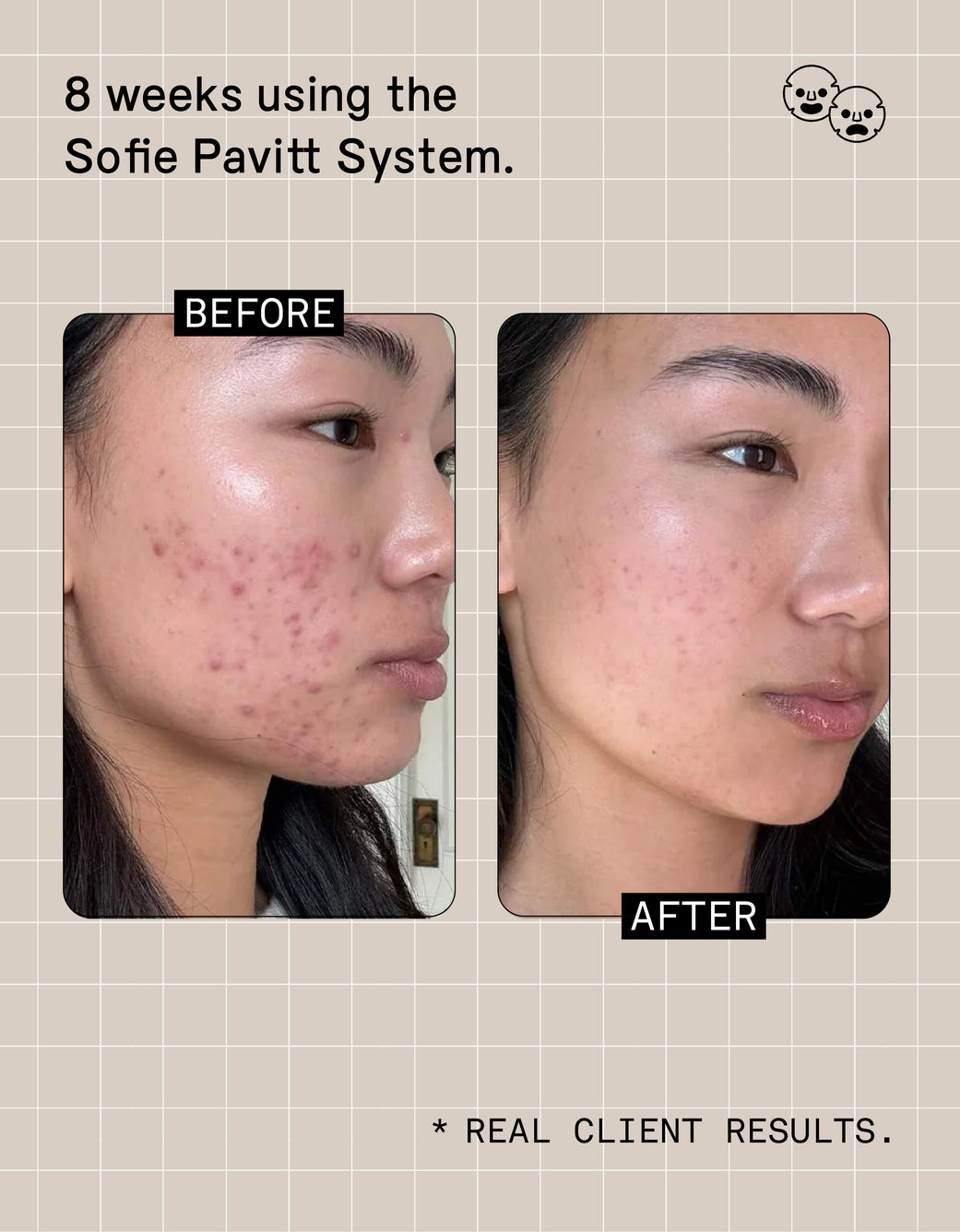 The Sofie Pavitt Skincare System